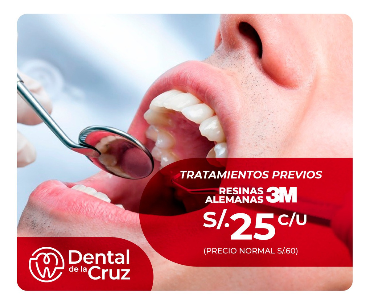 Brackets, ortodoncia, tratamiento ortodoncico sin inicial