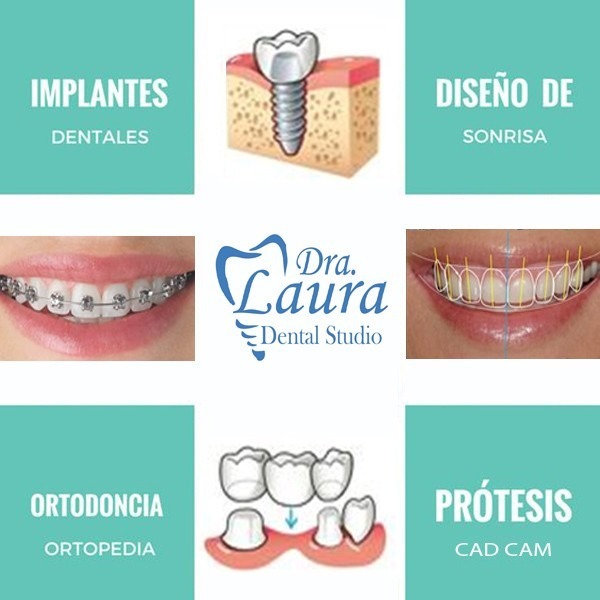 Implantes dentales campaña social!!