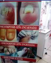 Podologia a domicilio ,separar tu cita llamando al 942981516