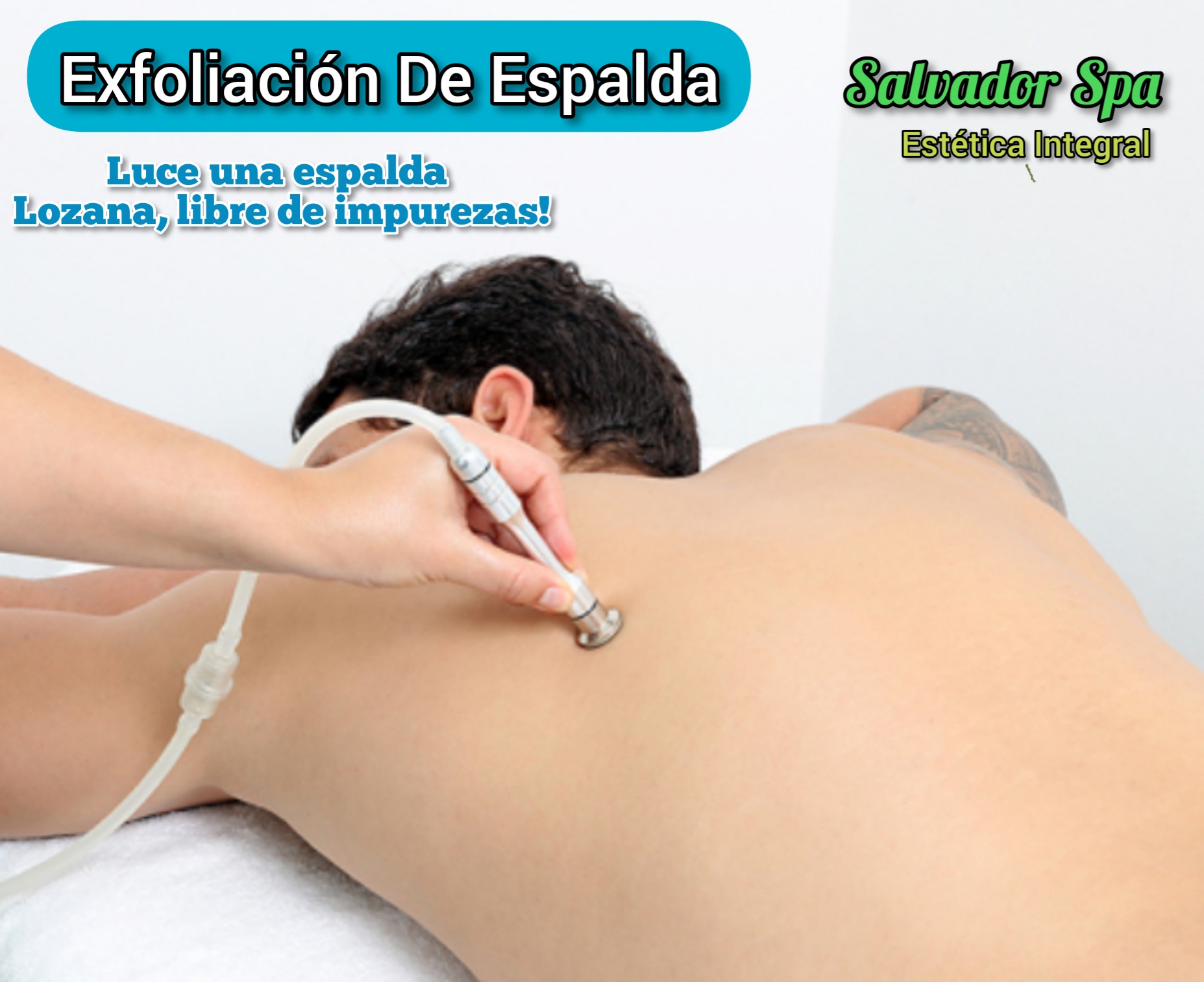 EXFOLIACIÓN DE ESPALDA SURCO-HIGUERETA